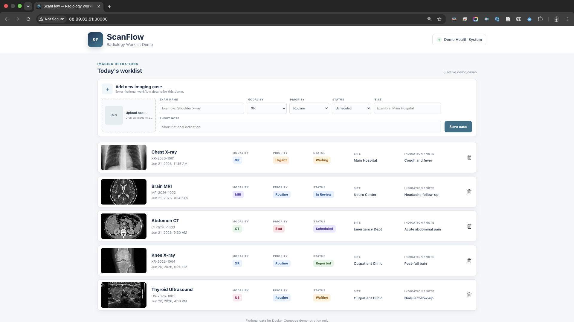 Radiology ScanFlow worklist showing imaging cases